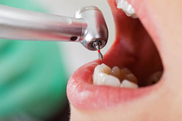 Best Cosmetic Emergency Dentistry in Central Heights Midland City, AZ